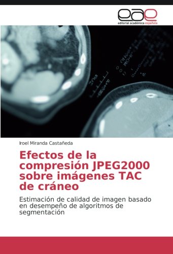 Efectos de la compresión JPEG2000 sobre imágenes TAC de cráneo: Estimación de calidad de imagen basado en desempeño de algoritmos de segmentación
