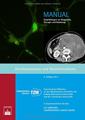 Knochentumoren und Weichteilsarkome: Empfehlungen zur Diagnostik, Therapie und Nachsorge (Manuale Tumorzentrum München)