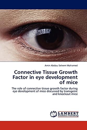 Connective Tissue Growth Factor in eye development of mice: The role of connective tissue growth factor during eye development of mice discussed by transgenic and knockout mice