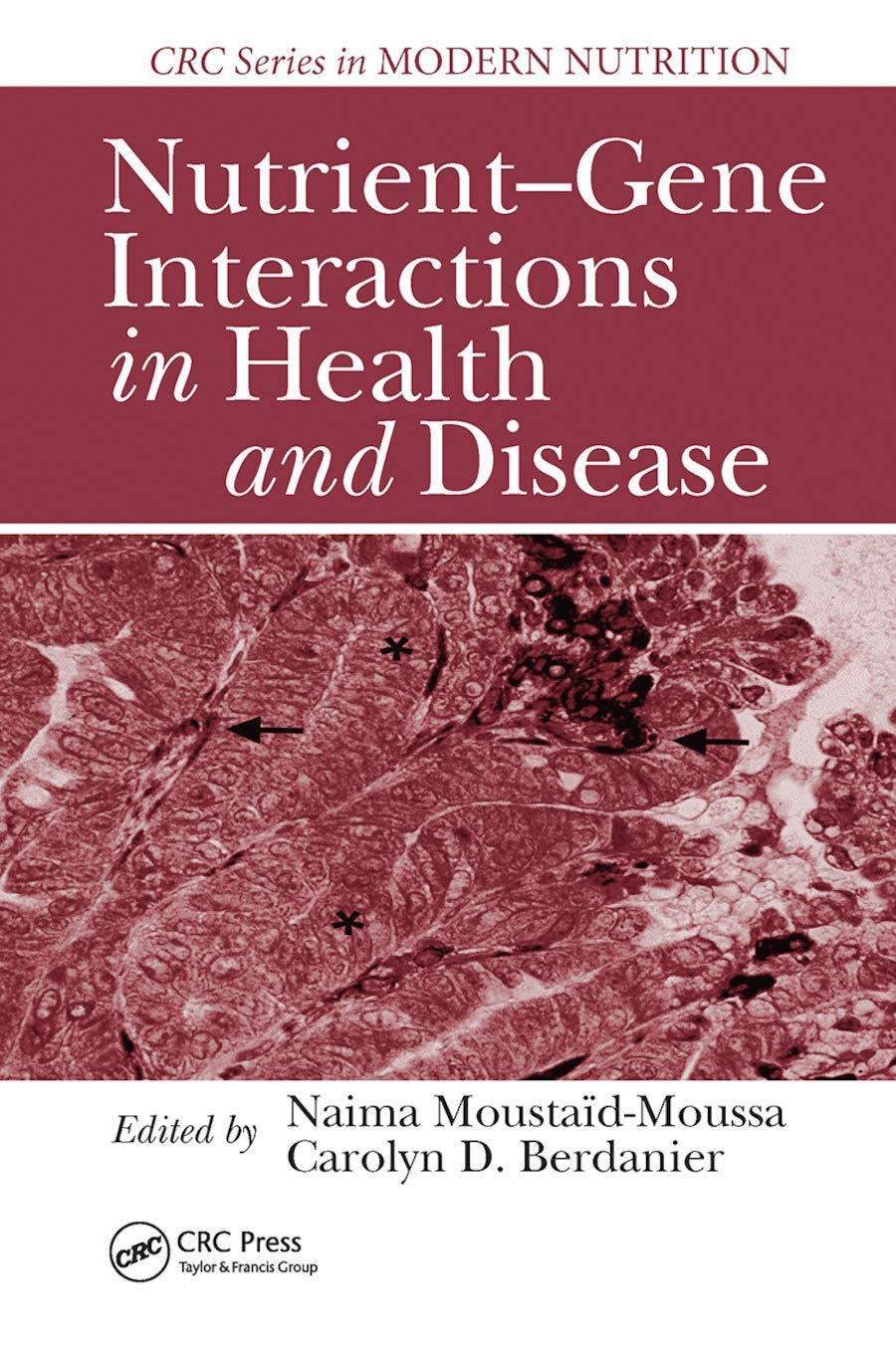 Nutrient-Gene Interactions in Health and Disease (Modern Nutrition)