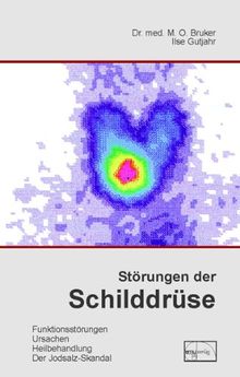 Störungen der Schilddrüse: Was man über die Schilddrüse wissen sollte. Störungen, Ursachen, Heilbehandlung, Warnung vor jodiertem Salz