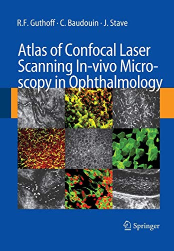 Atlas of Confocal Laser Scanning In-vivo Microscopy in Ophthalmology: Principles and Applications in Diagnostic and Therapeutic Ophtalmology