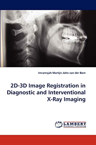 2D-3D Image Registration in Diagnostic and Interventional X-Ray Imaging