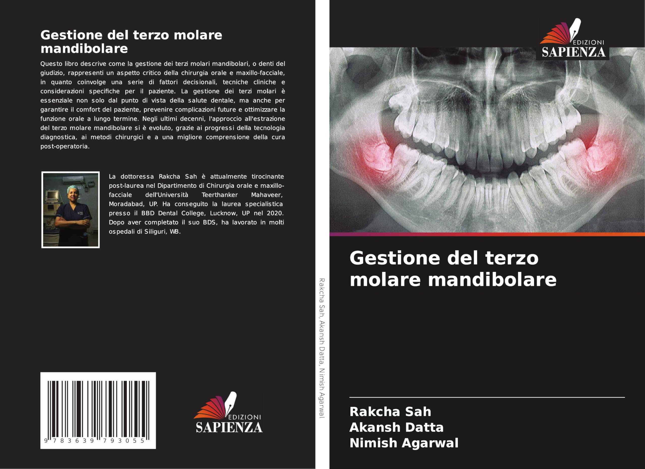 Gestione del terzo molare mandibolare