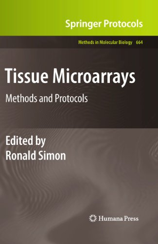 Tissue Microarrays: Methods and Protocols (Methods in Molecular Biology, 664, Band 664)