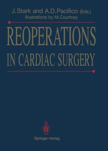 Reoperations in Cardiac Surgery