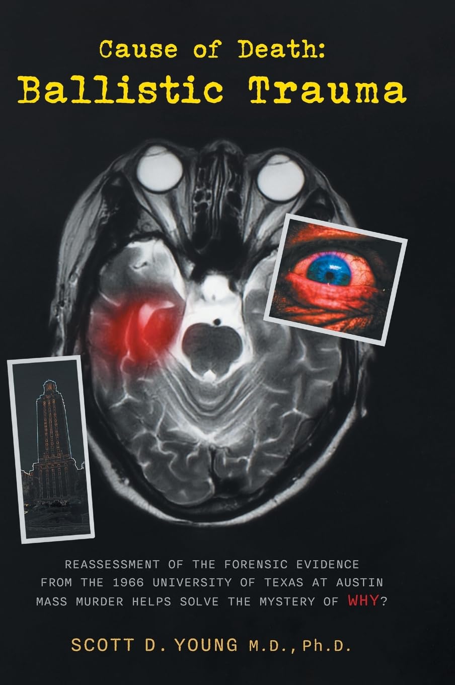Cause of Death: Ballistic Trauma: Reassessment of the Forensic Evidence from the 1966 University of Texas at Austin Mass Murder Helps Solve the Mystery of Why?