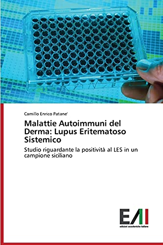 Malattie Autoimmuni del Derma: Lupus Eritematoso Sistemico: Studio riguardante la positività al LES in un campione siciliano