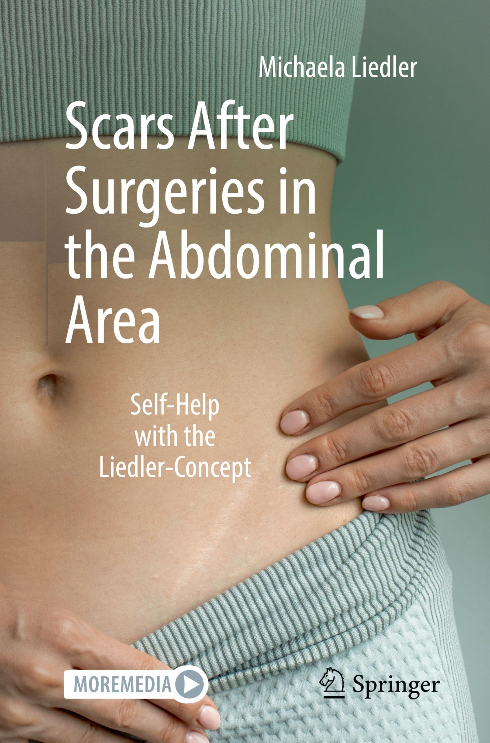 Scars After Surgeries in the Abdominal Area: Self-Help with the Liedler-Concept