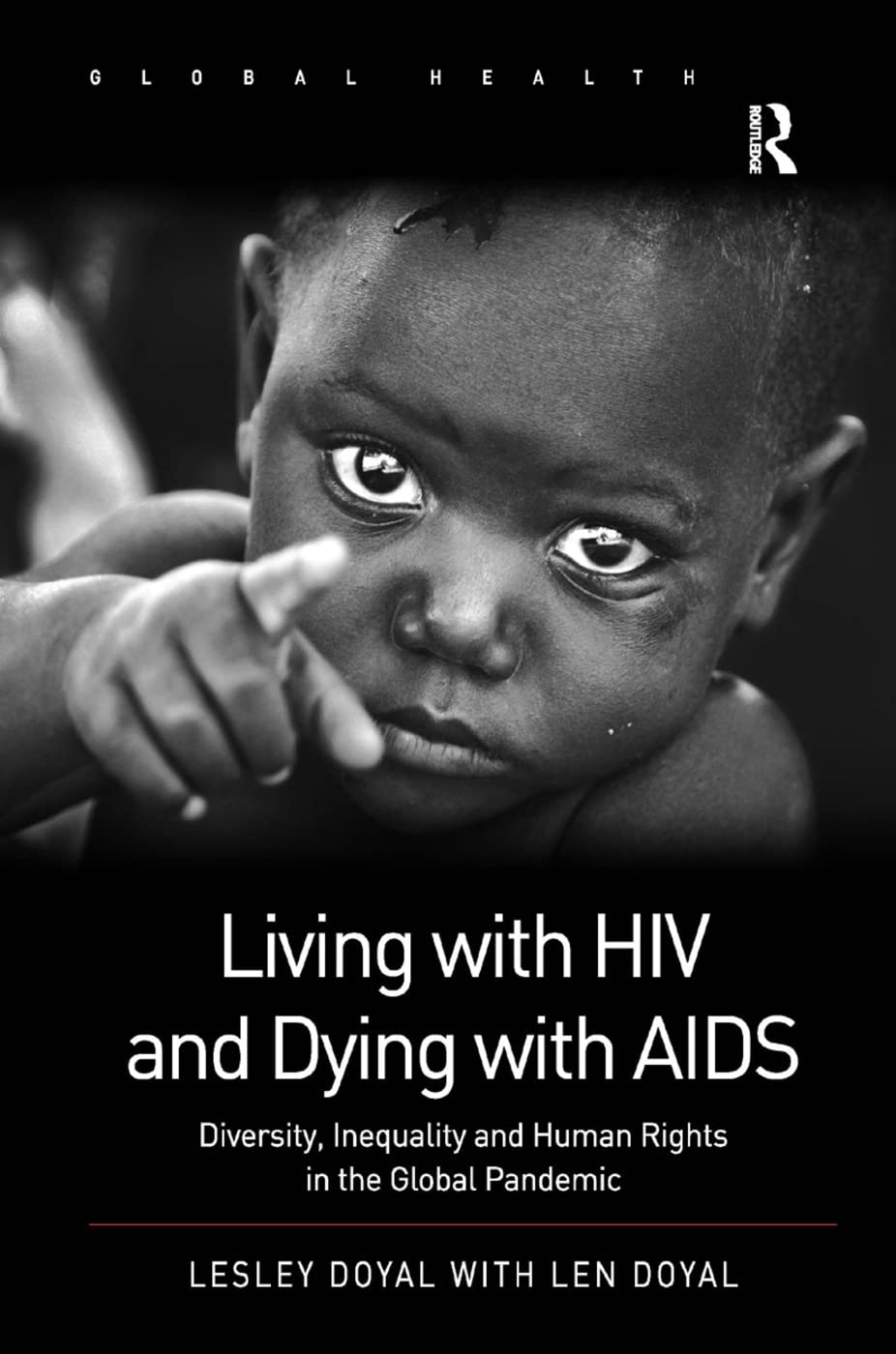 Living with HIV and Dying with AIDS: Diversity, Inequality and Human Rights in the Global Pandemic (Global Health)