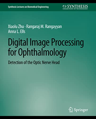 Synthesis Lectures on Biomedical Engineering   Digital Image Processing for Ophthalmology - Xiaolu Zhu Rangaraj Rangayyan Anna L Ells Kartoniert (TB)
