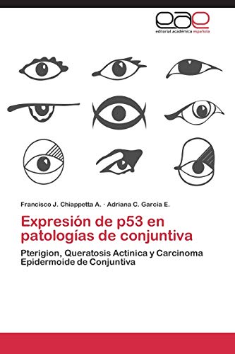 Expresión de p53 en patologías de conjuntiva: Pterigion, Queratosis Actinica y Carcinoma Epidermoide de Conjuntiva