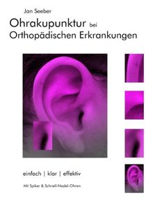 Ohrakupunktur bei Orthopädischen Erkrankungen: Balancierte Ohrakupunktur: einfach, klar, effektiv