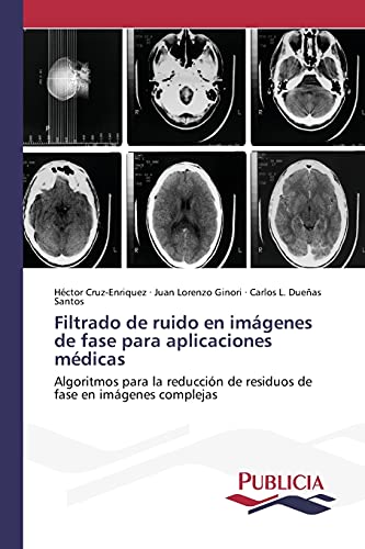 Filtrado de ruido en imágenes de fase para aplicaciones médicas: Algoritmos para la reducción de residuos de fase en imágenes complejas