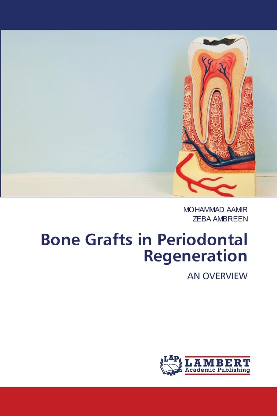 Bone Grafts in Periodontal Regeneration: AN OVERVIEW