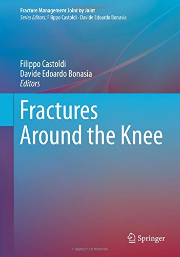 Fractures Around the Knee (Fracture Management Joint by Joint)