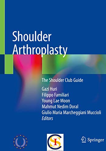 Shoulder Arthroplasty: The Shoulder Club Guide