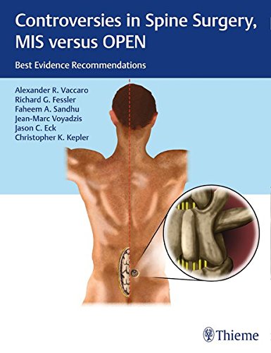 Controversies in Spine Surgery, MIS versus OPEN: Best Evidence Recommendations