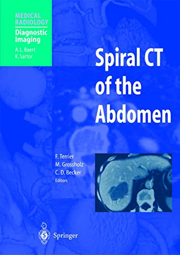 Spiral CT of the Abdomen (Medical Radiology)