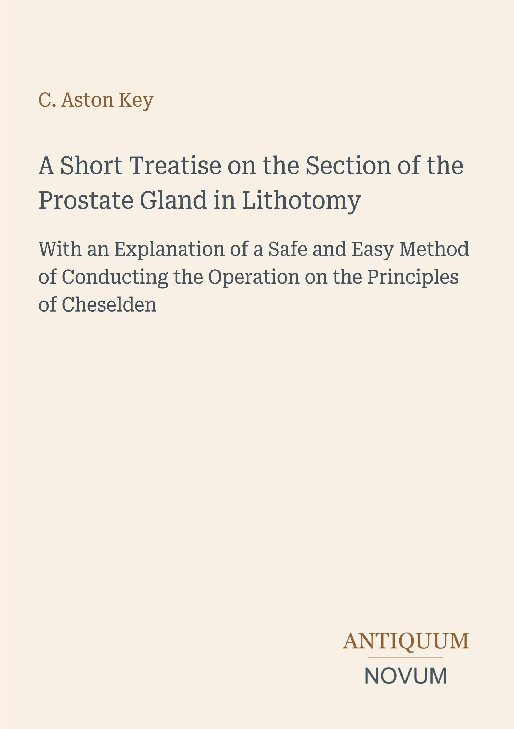 A Short Treatise on the Section of the Prostate Gland in Lithotomy