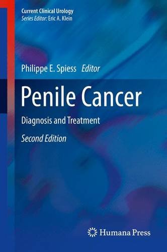 Penile Cancer: Diagnosis and Treatment (Current Clinical Urology)