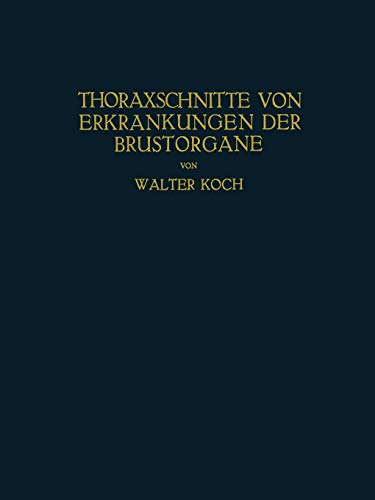 Thoraxschnitte Von Erkrankungen Der Brustorgane: Ein Atlas