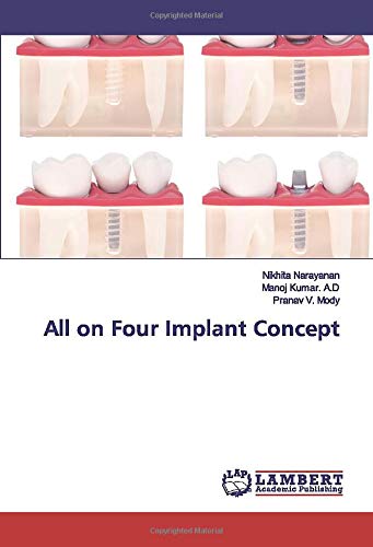 All on Four Implant Concept