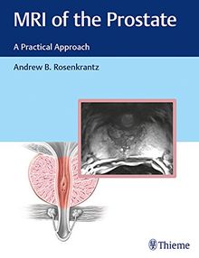 MRI of the Prostate: A Practical Approach