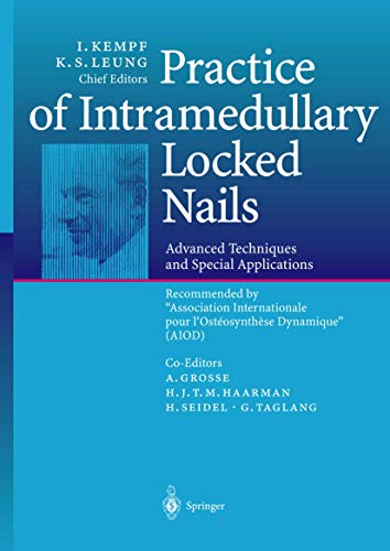 Practice of Intramedullary Locked Nails: Advanced Techniques and Special Applications Recommended by Association Internationale pour l'Ostéosynthèse Dynamique (AIOD)