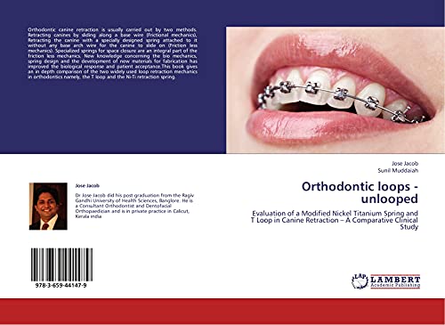 Orthodontic loops - unlooped: Evaluation of a Modified Nickel Titanium Spring and T Loop in Canine Retraction ¿ A Comparative Clinical Study