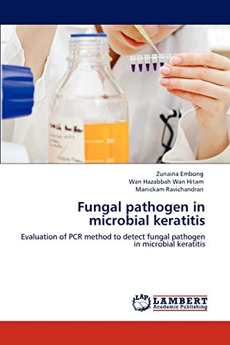 Fungal pathogen in microbial keratitis: Evaluation of PCR method to detect fungal pathogen in microbial keratitis