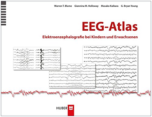EEG-Atlas: Elektroenzephalografie bei Kindern und Erwachsenen