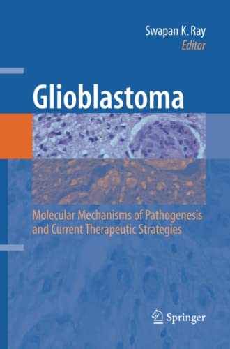 Glioblastoma:: Molecular Mechanisms of Pathogenesis and Current Therapeutic Strategies