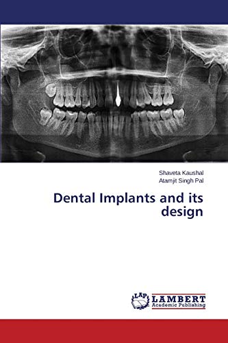 Dental Implants and its design
