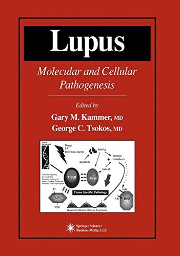 Lupus (Contemporary Immunology)