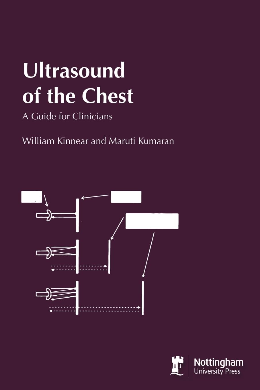 Ultrasound of the Chest: A Guide for Clinicians