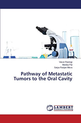 Pathway of Metastatic Tumors to the Oral Cavity