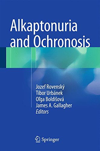 Alkaptonuria and Ochronosis