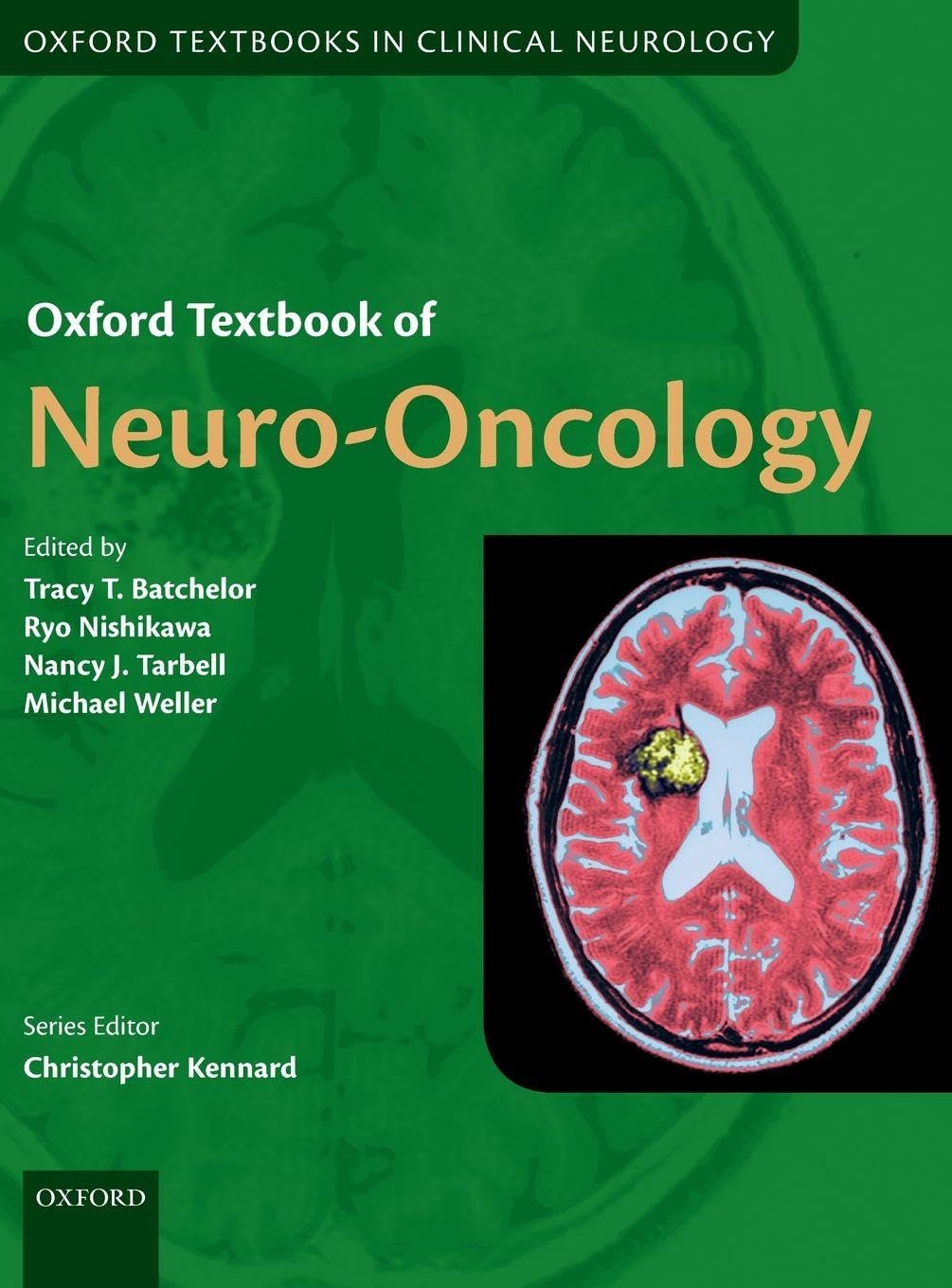 Oxford Textbook of Neuro-Oncology (Oxford Textbooks in Clinical Neurology)