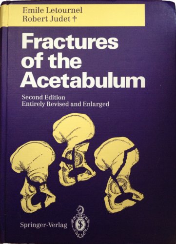 Fractures of the Acetabulum