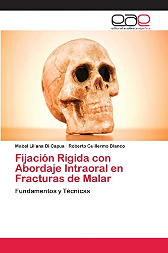 Fijación Rígida con Abordaje Intraoral en Fracturas de Malar: Fundamentos y Técnicas