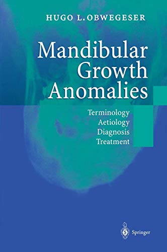 Mandibular Growth Anomalies: Terminology - Aetiology Diagnosis - Treatment