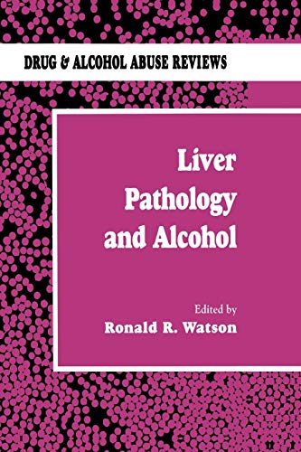 Liver Pathology and Alcohol: Drug & Alcohol Abuse Reviews (Drug and Alcohol Abuse Reviews): Drug & Alcohol Abuse Reviews (Drug and Alcohol Abuse Reviews, 2, Band 2)