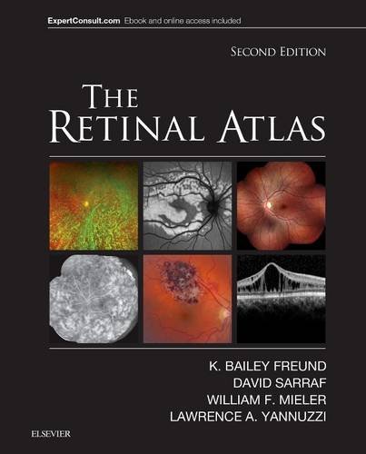 Freund, K. Bailey The Retinal Atlas, Expert Consult - Online And Print