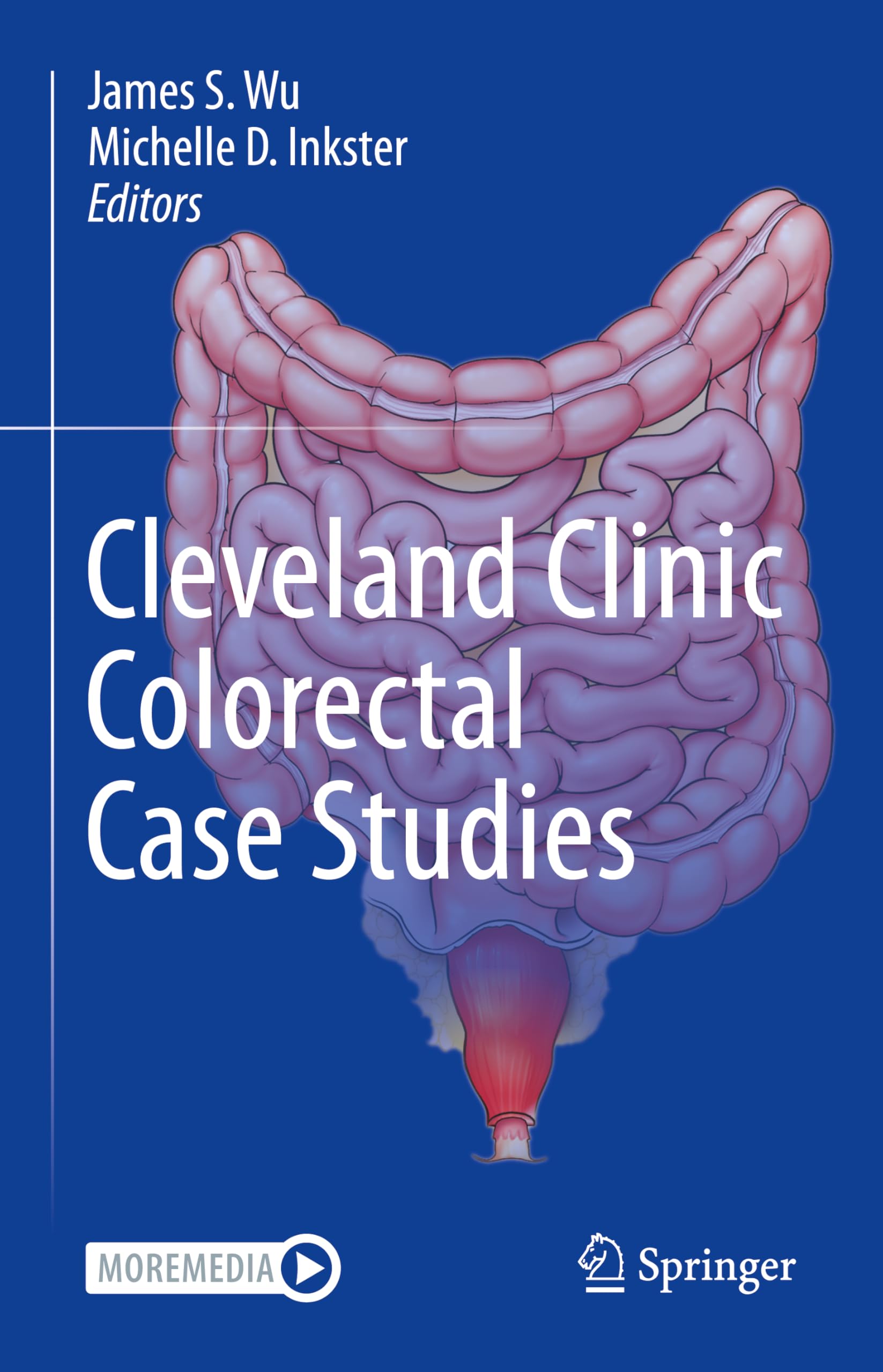 Cleveland Clinic Colorectal Case Studies