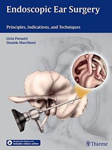 Endoscopic Ear Surgery: Principles, Indications, and Techniques