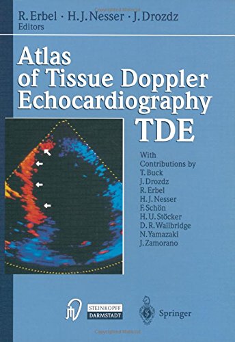 Atlas of Tissue Doppler Echocardiography - Tde