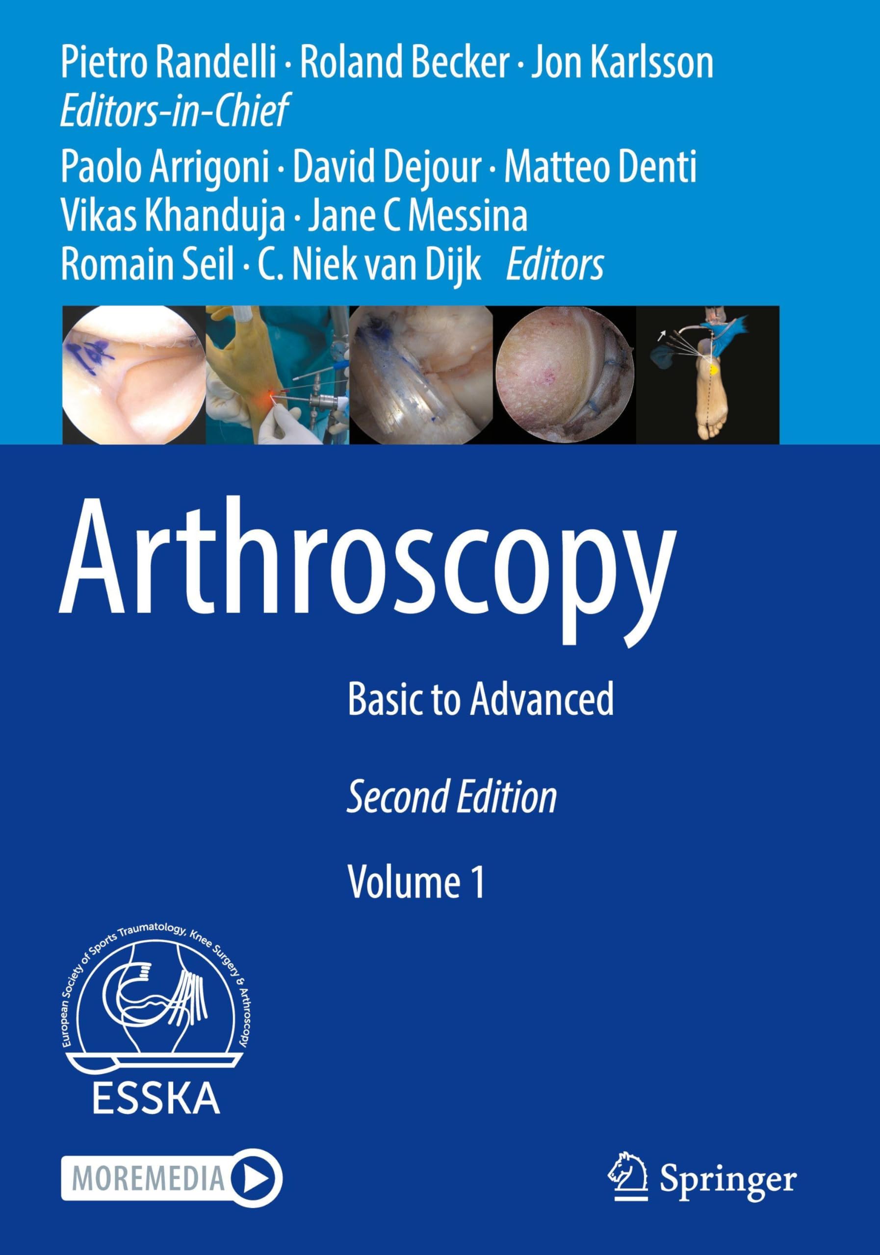 Arthroscopy