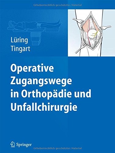 Operative Zugangswege in Orthopädie und Unfallchirurgie