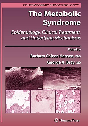 The Metabolic Syndrome:: Epidemiology, Clinical Treatment, and Underlying Mechanisms (Contemporary Endocrinology)